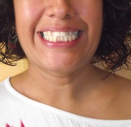 Antes - Tania